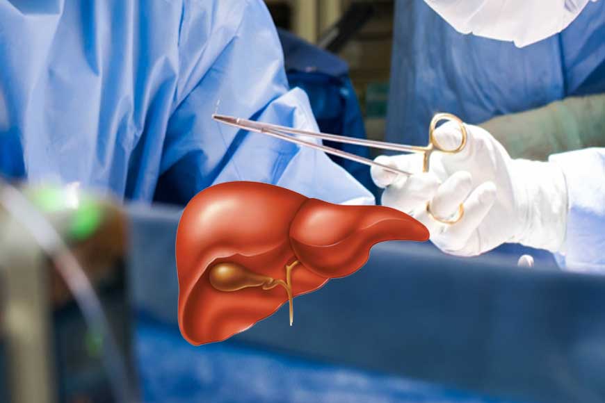 Good News! Kolkata gets 4th Liver Transplant Unit
