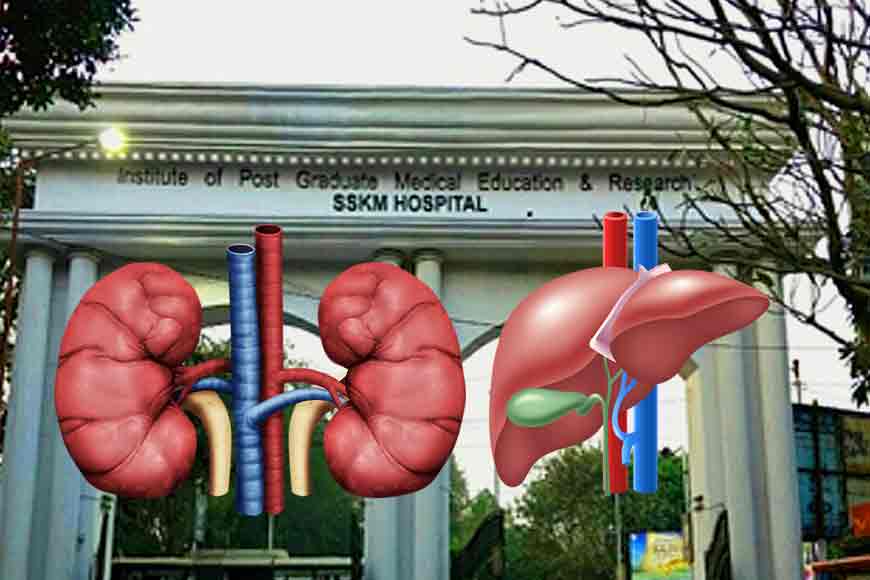 SSKM scripts history today with liver transplant through organ donation
